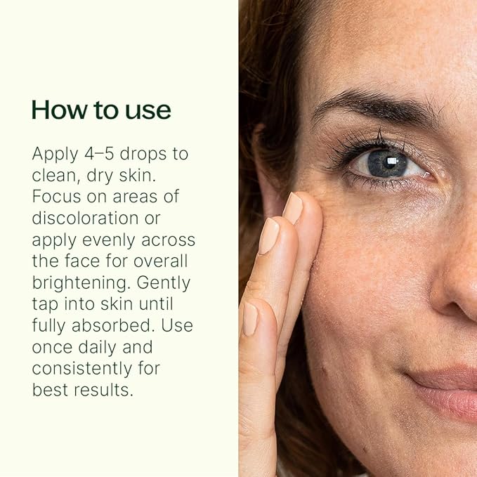 Plant Therapy Dark Spot Facial Oil 30 mL (1 oz) Visibly Reduces the Look of Dark Spots, and Scars, Promotes a More Even, Brighter-Looking Tone, Defends Against Discoloration-Causing Stressors