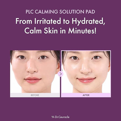 Dr.Ceuracle PLC Calming Solution Pad - Instant Calming and Soothing Toner Pad for Sensitive Skin, Korean Post Laser Skincare (130 Pads)
