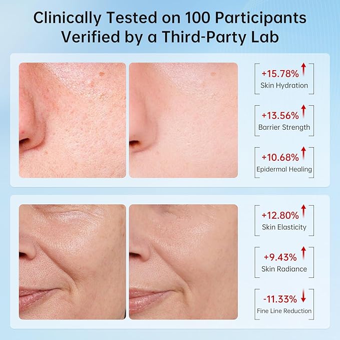 VGO 2 Pack 92% Snail Mucin Moisturizer, Anti Aging, Skin Repair & Hydrating Face Cream with Ceramide & Vitamin E