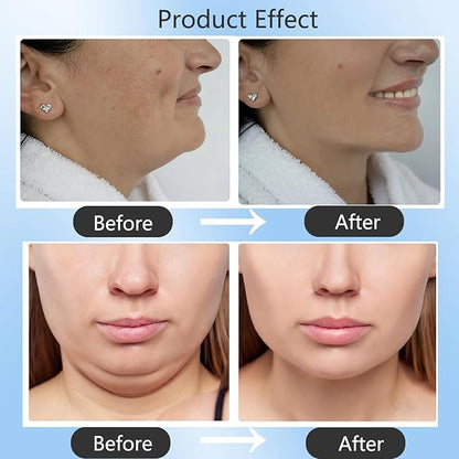 Double Chin Lifting Mask, Reusable Upgraded Double Chin Reducer, Helps Create A Three-Dimensional Jawline, Sleep Mask for Face and Neck Upgraded Deep Collagen Firming Mask (5 Pcs)