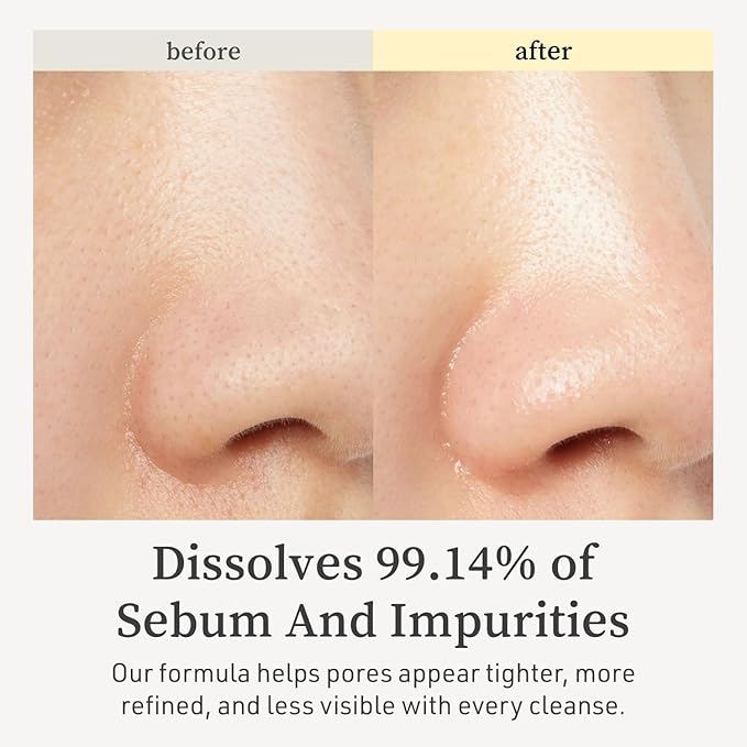 NOONI Korean Cleansing Oil - Snow Aqua 0 LHA Toning Cleansing Oil | Makeup Blackhead Remover, Pore Control, Glass Skin, Help Control Sebum, Revitalizing, Moisturizing, Korean Skin Care, 6.76 Fl Oz