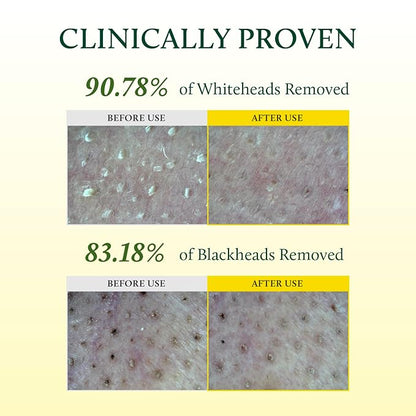 YADAH Cactus Pore Deep Cleansing Oil (6.76 Fl Oz) – Lightweight Daily Facial Cleanser & Daily Makeup Remover with Cactus Seed Oil for Pore Purifying & Balanced Skin, Double Cleansing Korean Skincare