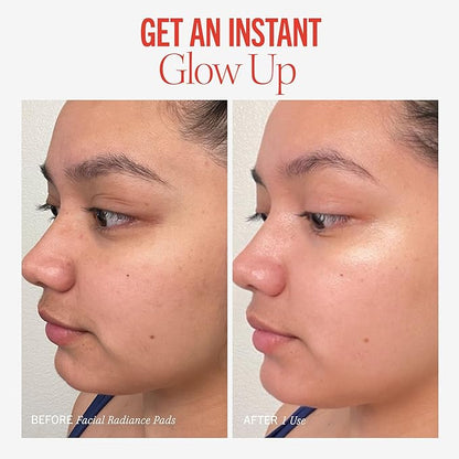 First Aid Beauty - Facial Radiance Pads with Glycolic & Lactic Acids, Daily Exfoliating Pads with AHA, Visibly Smaller Pores, Help Tone & Brighten Skin, One-Step Makeup Prep, Compostable, 90