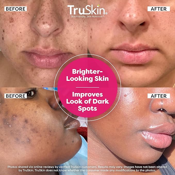 TruSkin Vitamin C Super Serum - Niacinamide, Retinol, Hyaluronic Acid & Squalane - All-in-One Anti Aging Serum for Face – Improve Appearance of Dark Spots, Firmness for Brighter Looking Skin, 2 Fl Oz