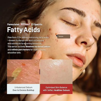 Zeroca 81 Korean Calming Serum for Acne-Prone & Oily Skin – Balances Oil-Water, Soothes Redness, Fades Post-Blemish Marks, Firms & Hydrates (1.01 fl.oz. 30 ml)