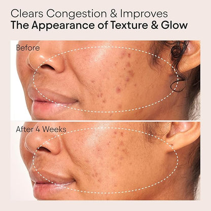 ALPYN Clarifying Facial Oil with Retinol & Pink Algae | Clear Congestion, Smooth Fine Lines, Improve Texture & Glow | 1 Fl Oz / 30 ml