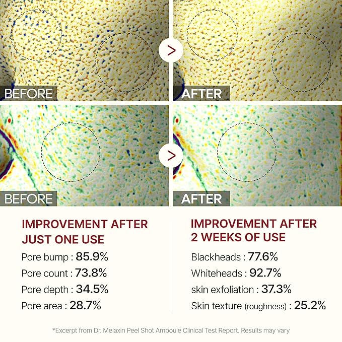 Dr.Melaxin Peel Shot Glow Black Rice Peeling Ampoule 80ml Daily Soft Exfoliating Face and Body Scrub Dead Skin Cells Remover for All Skin Types korean skin care