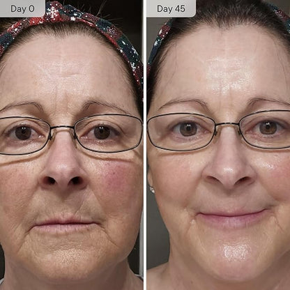 Qure Micro Infusion System for Face & Neck - Facial Moisturizing Essence, Even-looking tone, Serum for All Skin Types, Refreshed and Luminous Skin - 5-Month Supply