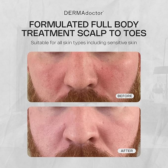 DERMAdoctor Tranquility Cleanser Dermatologist Formulated 2% Pyrithione Zinc for face body & Scalp - 7.10 oz