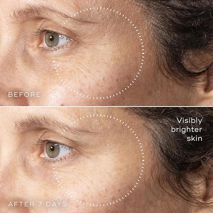 Medik8 C-Tetra Advanced - Balancing, Plumping, Hydrating Daily Vitamin C Serum with Hyaluronic Acid, Squalene - Smooths Fine Lines, Wrinkles - 1.0 oz