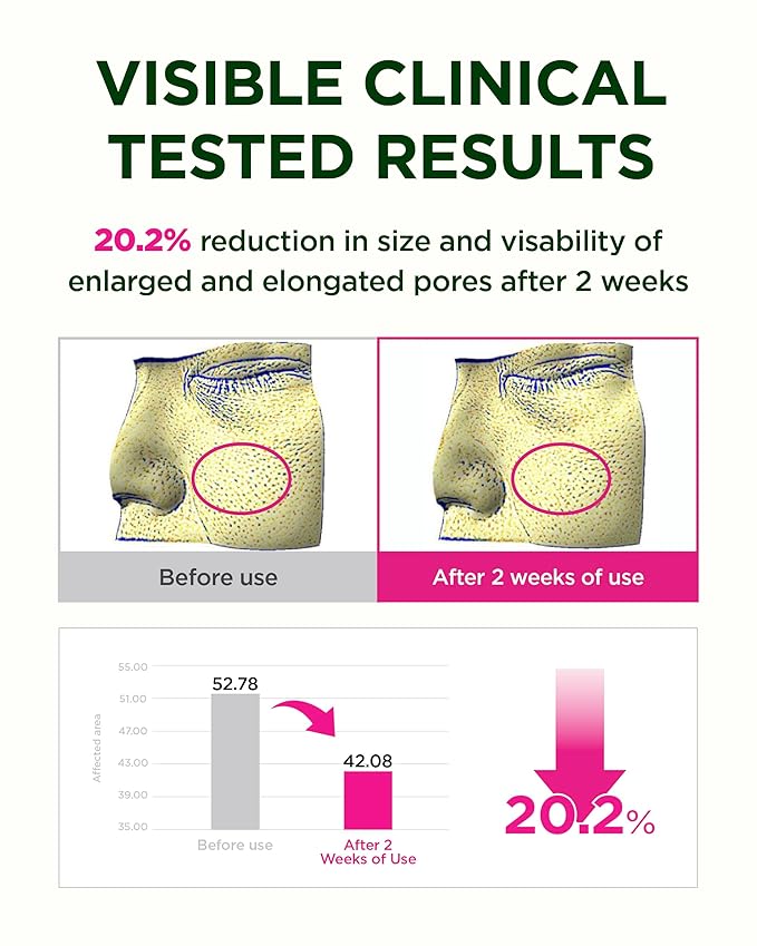 CKD Retino Collagen Boosting Hydrogel Face Mask (5ea) - Korean Firming Jelly Mask for Glass Skin, Pore Minimizing and Moisturizing with Retinal & Low Molecular Collagen. Korean Skin Care.