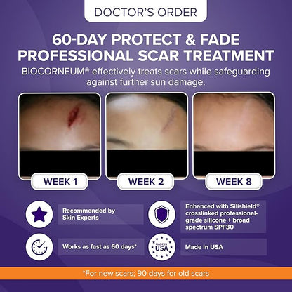 Biocorneum Advanced Scar Treatment with Silishield® & SPF 30 20g – Fast-Drying, Water-Resistant Silicone Scar Gel - Surgeon Recommended Scar Removal for New & Old Scars - Suitable for Children