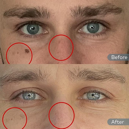 Onekind Dream Cream Night Moisturizer – Hydrating Anti-Aging Face Cream with Squalane, Rosehip & Shea Butter – Fragrance-Free, Vegan, for Dry & Sensitive Skin – 1.7 oz