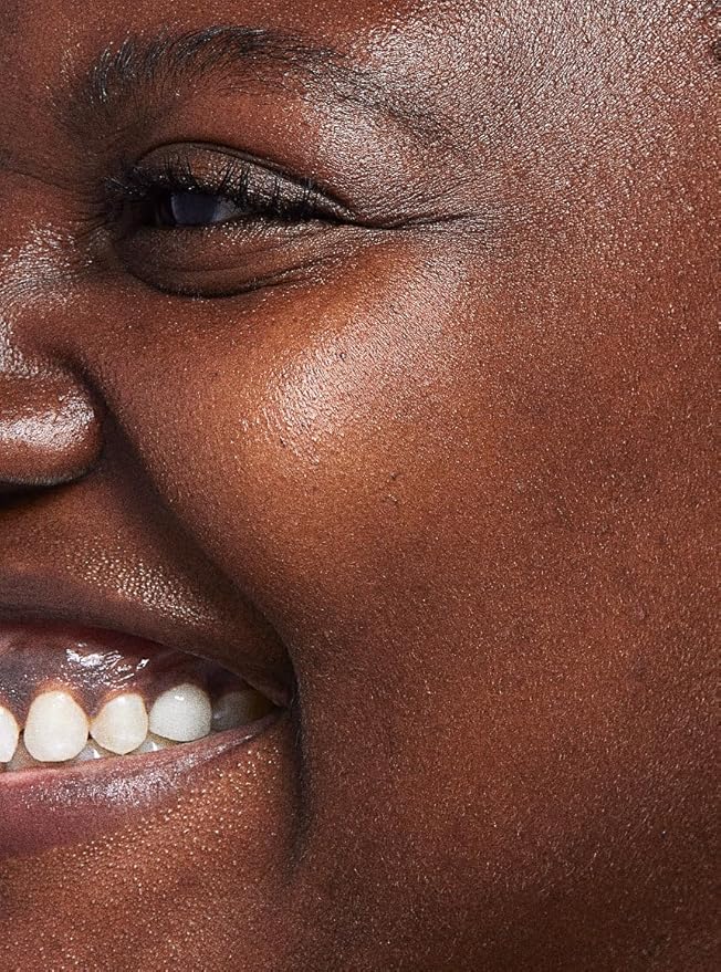 LEROSETT Serum for Acne Scarring Healing, Pimples, Redness, Breakouts, Blemishes, Hydrate & Soothes Irritated Skin, Natural Serum. Spa-Grade, Plant Based, Concentrated - 4 oz