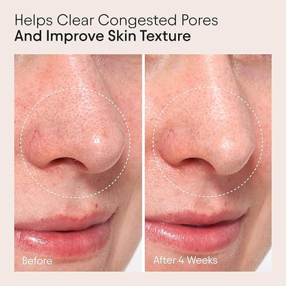 ALPYN Clarifying Facial Oil with Retinol & Pink Algae | Clear Congestion, Smooth Fine Lines, Improve Texture & Glow | 1 Fl Oz / 30 ml